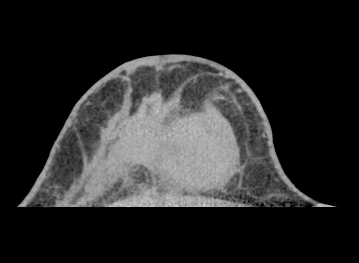 臨床症例画像01