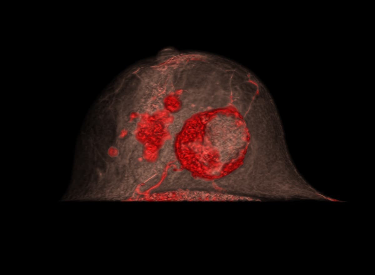 臨床症例画像04