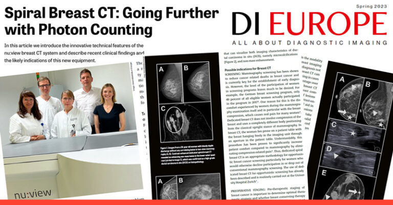 スパイラル乳腺CT：フォトンカウント技術によるさらなる進化